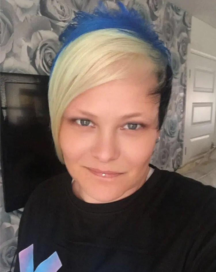 Nguoi phu nu phai phau thuat 55 lan vi mot vet xuoc