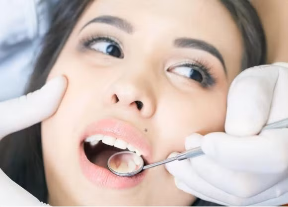 Vi sao benh ung thu mieng ngay cang nhieu, chu yeu la phu nu?-Hinh-6