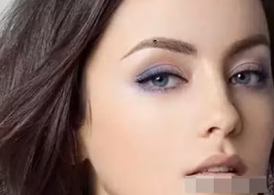 Not ruoi o nhung bo phan nay deu la not ruoi may man, dung tay-Hinh-3