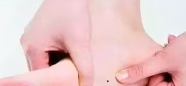 Not ruoi o nhung bo phan nay deu la not ruoi may man, dung tay-Hinh-4