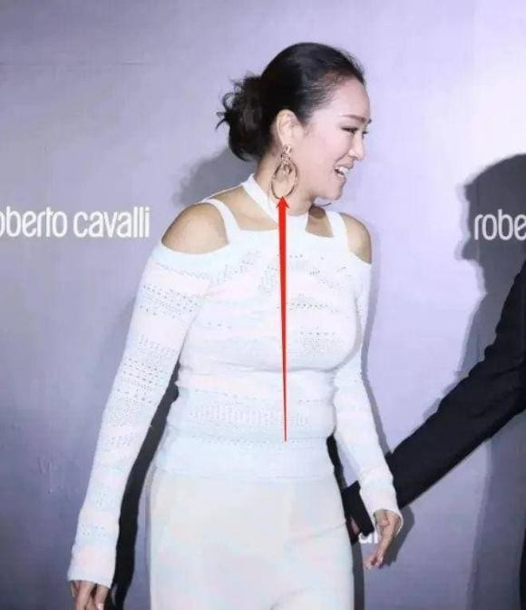 Cung Loi ngoai hinh khac la o tuoi 57