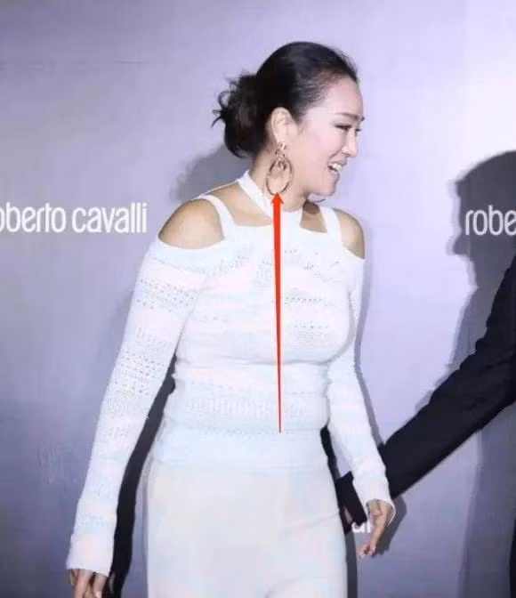 Cung Loi ngoai hinh khac la o tuoi 57