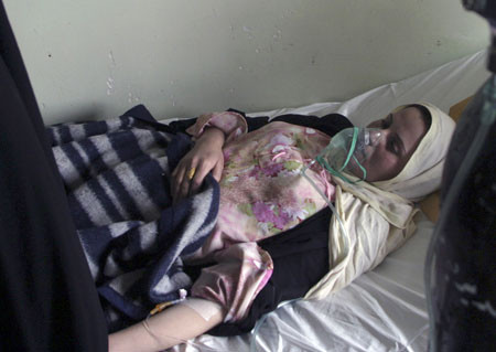 Clo đã được sử dụng lần đầu tiên như một vũ khí hóa học bởi quân Đức tại trận thứ hai ở Ypres ngày 22/4/1915 trong Chiến tranh thế giới 2. Người Đức đã triển khai hàng ngàn bình khí clo và đã tiêu diệt toàn bộ 2 sư đoàn của Pháp và Algeria. Khi tiếp xúc với Clo, nó gây đau nhói phía sau của cổ họng và ngực. Clo có thể phản ứng với nước trong niêm mạc của phổi để tạo thành axit clohydric - một chất kích thích có thể làm chết người. Nạn nhân cảm giác như mình đang bị thiêu cháy. Ảnh: Nạn nhân khí Clo.