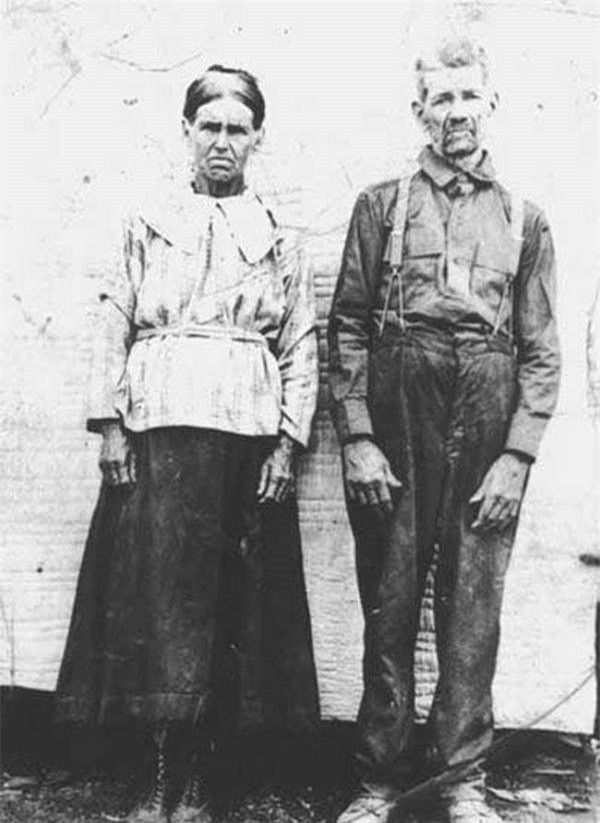 Kỳ lạ những gia tộc ở Kentucky có màu da xanh như Xì Trum ảnh 3