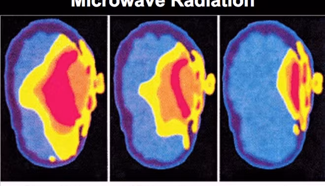 Dien thoai di dong co the gay ung thu nao, vo sinh