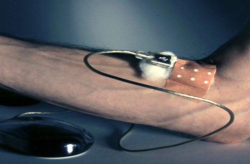  Dễ bị nghiện. Khoa học đã đưa thêm một hội chứng có tên “Hỗn loạn trong sử dụng Internet”. Đây là căn bệnh mà người bệnh bị nghiện Internet. HỌ sẽ cảm thấy không thoải mái khi không được onl.