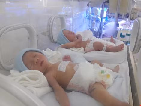 Cặp song sinh nhờ mang thai hộ kháu khỉnh vẫn đang được các bác sĩ chăm sóc. Ảnh: HÀ PHƯỢNG