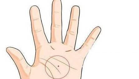 Nguoi co not ruoi nay tren tay thi phuc loc truong tho-Hinh-2