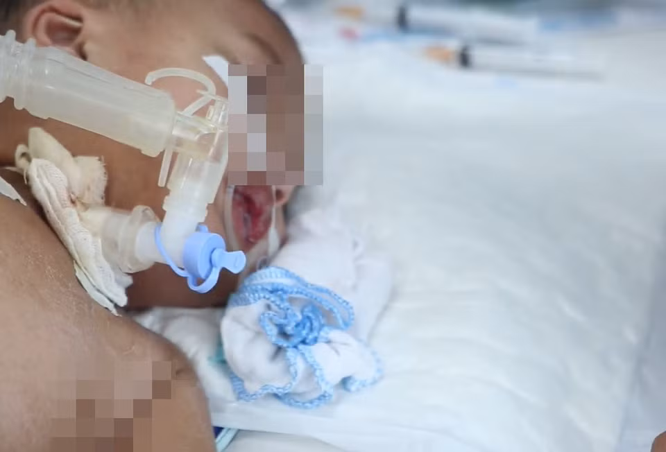 Be 2 tuoi gap bien chung rat nang sau nhiem Adenovirus