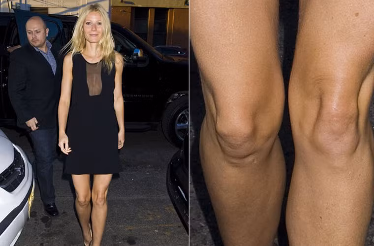 Đầu gối của Gwyneth Paltrow có lẽ là bộ phận xấu xí nhất trên cơ thể cô.