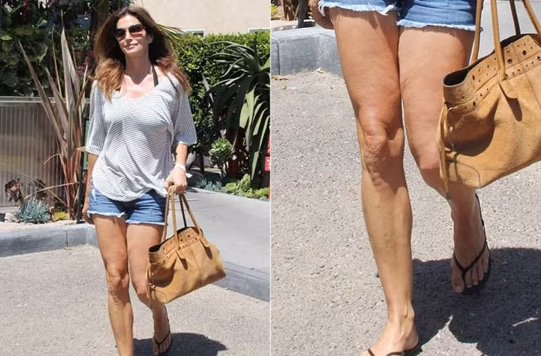 Siêu mẫu một thời Cindy Crawford dù có tập luyện, ăn uống lành mạnh cũng không ngăn nổi kẻ thù thời gian hiện hữu trên đôi chân nuột nà ngày nào.