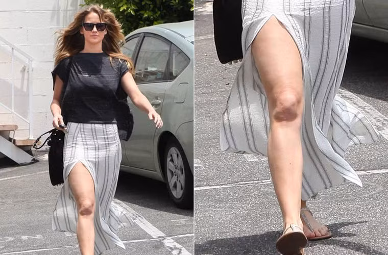 Không bị nhăn nhúm, chảy nhão, nhưng vùng da đầu gối của Jennifer Lawrence lại bị chứng sần vỏ cam xấu xí.