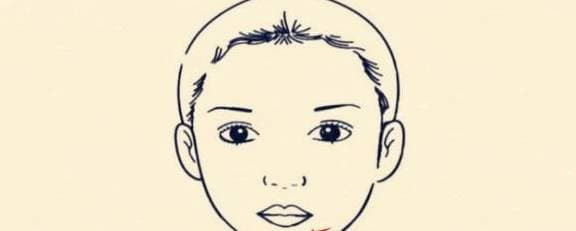 Sau not ruoi vuong phu tren co the, nam vuong vo, nu vuong chong-Hinh-3