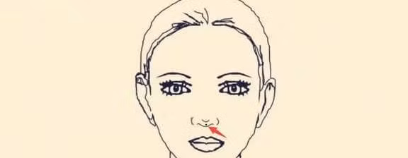 Sau not ruoi vuong phu tren co the, nam vuong vo, nu vuong chong-Hinh-4