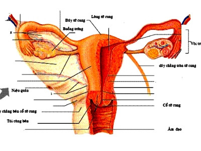 Nếu không điều trị kịp thời có thể dẫn tới hẹp, dính tử cung.