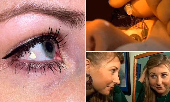 Cận cảnh trang sức trong mắt của Lucy Luckayanko