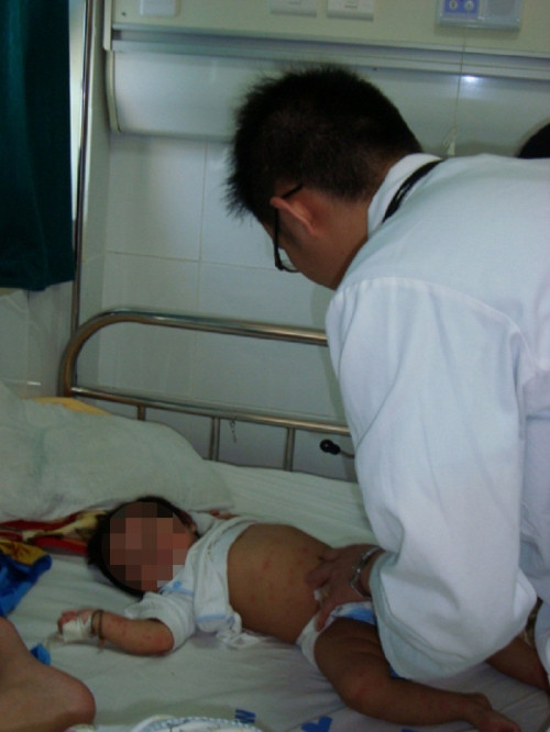 Có nhiều trường hợp chỉ vì chủ quan mà trẻ bị viêm màng não thể nặng.