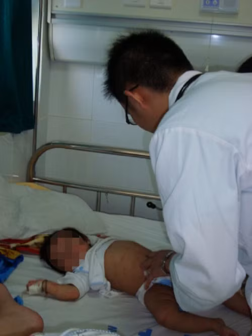 Có nhiều trường hợp chỉ vì chủ quan mà trẻ bị viêm màng não thể nặng.