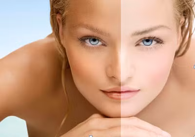 Không nên sử dụng các sản phẩm làm trắng da, tẩy da chết ngay cả khi các vết thâm hình thành. Sự thay đổi sắc tố da trong giai đoạn bầu bí là chuyện bình thường, nếu ngay lập tức dùng kem làm trắng da sẽ gây tổn thương da, nếu nặng gây nhiễm trùng và mắc một số bệnh viêm da cấp tính.