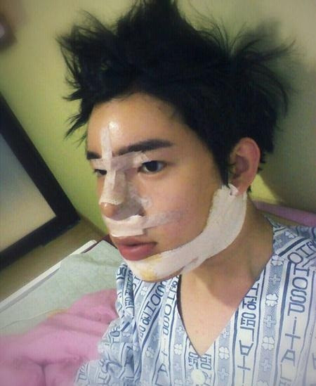 Khuôn mặt chàng trai gần như sửa hoàn toàn từ mắt đến mũi, cằm và da mặt, môi...