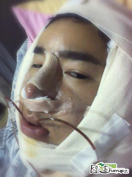 Những hình ảnh khuôn mặt quấn bông băng kín mít, chỉ khâu chằng chịt,... khiến không ít người phải giật mình kinh hãi.