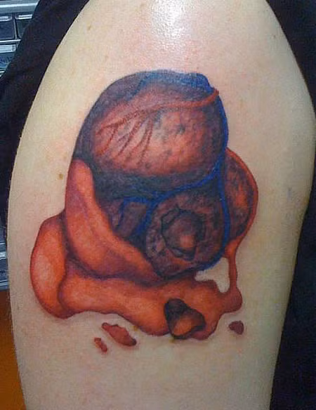 Hình xăm trái tim bị ung thư.