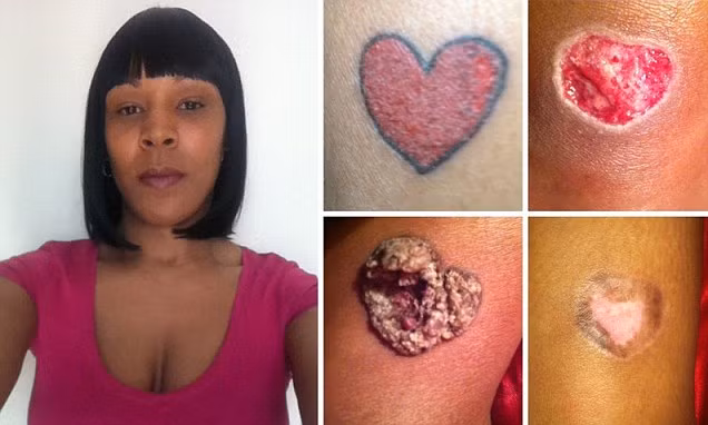 Có lẽ, cô Nicola sẽ không bao giờ dám thử xăm hình thêm bất cứ một lần nào nữa.