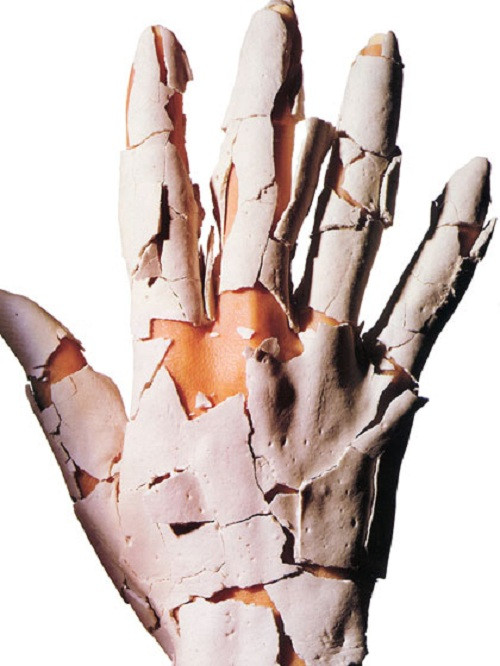 Lãng quên đôi tay. Ngoài việc tránh được buốt giá khi giặt rửa, việc đeo găng tay còn có một công dụng tuyệt vời nữa, đó là giúp móng tay không bị nứt, hay bong tróc. Vì các loại xà phòng rửa tay chống khuẩn có thể gây khô da, bạn hãy chọn loại sữa rửa dạng kem nhẹ, rửa sạch với nước hơi ấm và thoa kem dưỡng tay thường xuyên. Mỗi tuần, bạn nên chà dầu dưỡng tế bào biểu bì quanh móng để giữ ẩm.