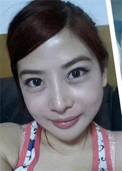 Sau 21 ngày, cô đã được tháo băng cố định hoàn toàn, khuôn mặt cũng đã gần như hết sưng tấy.