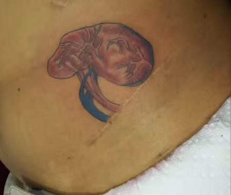 Hình xăm quả thận.