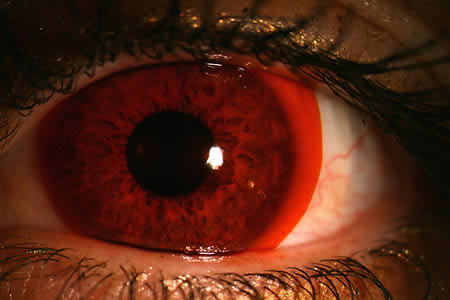 Hãng sản xuất đồ thể thao Nike luôn cho ra đời những sản phẩm độc đáo. Trong đó có sản phẩm kính áp tròng màu đỏ dành cho các VĐV đua xe đạp. Những VĐV đua xe đạp với cặp kính này để chống lại sức lóa của ánh mặt trời.