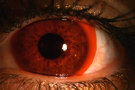 Hãng sản xuất đồ thể thao Nike luôn cho ra đời những sản phẩm độc đáo. Trong đó có sản phẩm kính áp tròng màu đỏ dành cho các VĐV đua xe đạp. Những VĐV đua xe đạp với cặp kính này để chống lại sức lóa của ánh mặt trời.