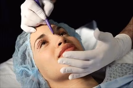 Nâng mũi Radies là một trong những kỹ thuật nâng mũi không dao kéo được các chuyên gia thẩm mỹ rất tín nhiệm. Phương pháp này không bóc tách, không xâm lấn nên không tạo cảm giác đau đớn hay áp lực tâm lý cho khách hàng.