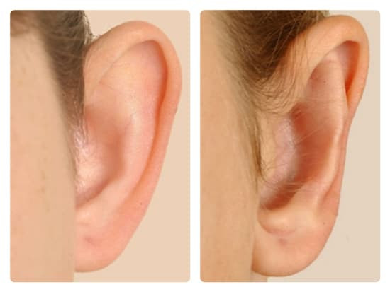 Tai đen, vành tai lồi lõm. Theo nhân tướng học, người có tai đen, vành tai lồi lõm thường có số mệnh nghèo khó, không thể làm nên nghiệp lớn.