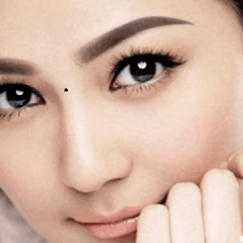  Nốt ruồi ở giữa sống mũi. Trong nhân tướng học chiếc mũi được gọi là cung Tài bạch, chủ về tài. Người có nốt ruồi ở vị trí này thường có mâu thuẫn về mặt kinh tế với chồng, dễ dẫn đến nguy cơ tan vỡ hôn nhân. Bên cạnh đó, người sở hữu nốt ruồi ở vị trí này thường khó lòng giữ được tiền bạc, nên cuộc sống dễ rơi vào túng thiếu. 