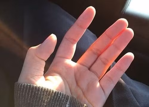 Nếu bạn có 4 dấu hiệu và điềm báo này gần đây, có nghĩa là tài vận của bạn sắp được cải thiện. Phần dưới của ngón trỏ trong lòng bàn tay trở nên hồng hào, đầy đặn. 