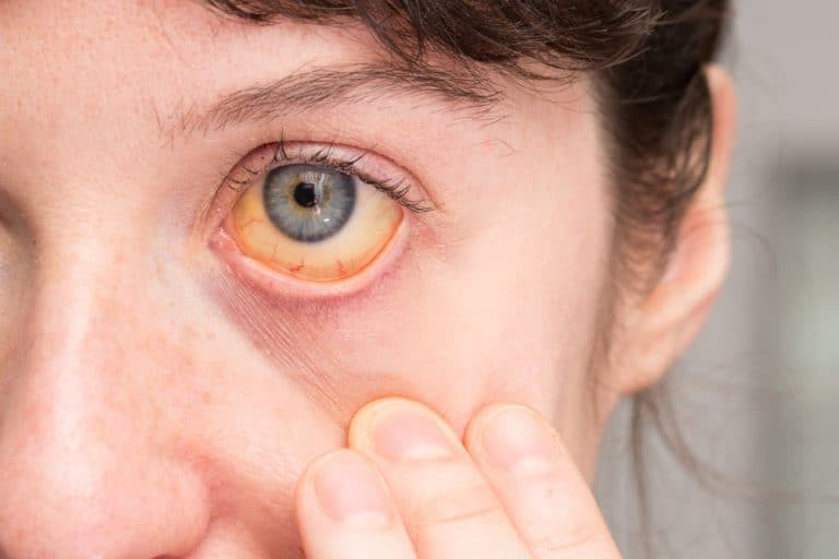 4 dau hieu bat thuong vao buoi sang cho thay xo gan, K gan den rat gan