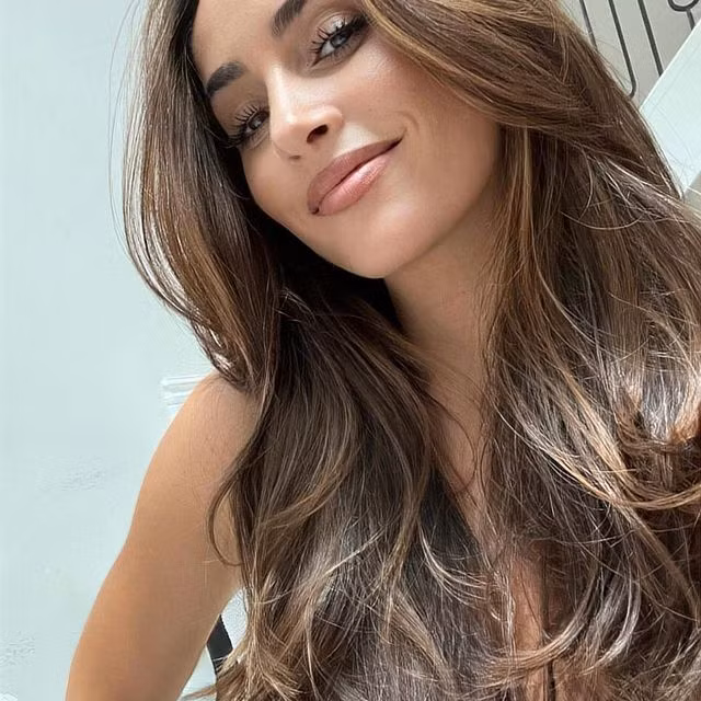 Xhaka va vo song cuc sang chanh du bi tuoc bang doi truong Arsenal-Hinh-9