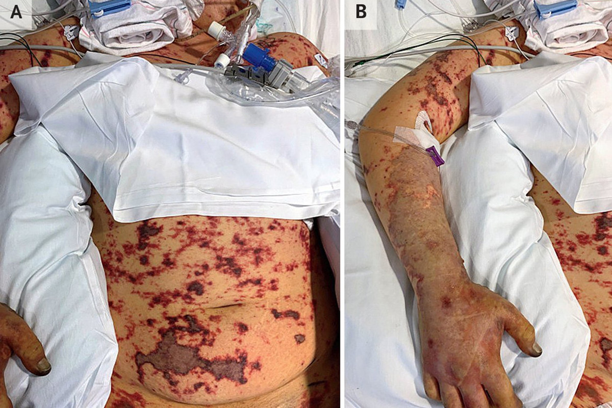 Thanh nien 19 tuoi o My phai cua tay, chan sau khi an thuc pham thua