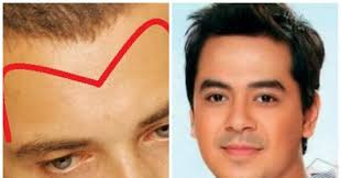 Nhin tran biet so menh: 5 tuong tran suong tu trong trung, ngoi mat an bat vang