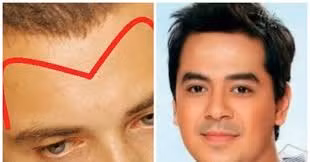 Nhin tran biet so menh: 5 tuong tran suong tu trong trung, ngoi mat an bat vang