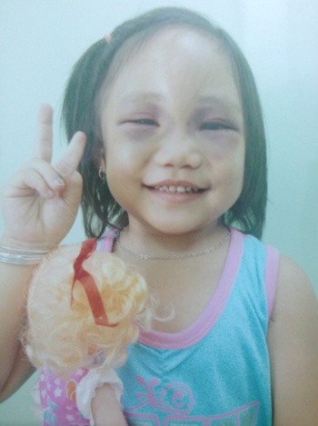 Cháu bé được cán bộ Ủy ban, Công an phường chăm sóc nên có phần "tươi sáng" hơn nhưng khi thấy cha xuất hiện thì hoảng loạn, sợ hãi.