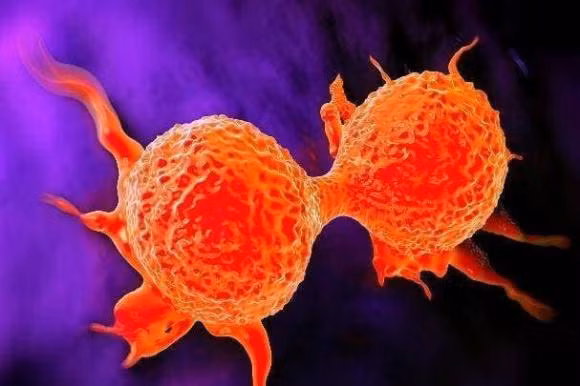 Neu o co co 3 “tin hieu” thi co the la bao hieu cho te bao ung thu “hoat dong”