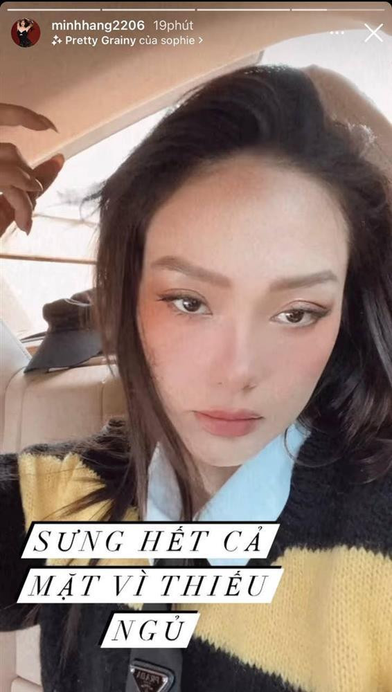 Minh Hằng "sưng hết cả mặt" trước thềm đám cưới - Hình 2 Minh Hang