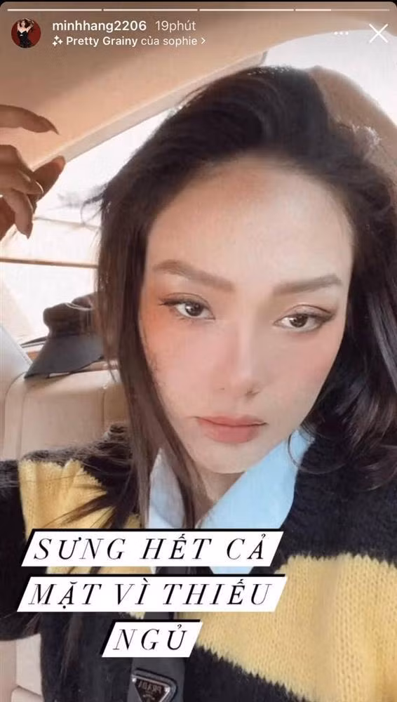 Minh Hằng "sưng hết cả mặt" trước thềm đám cưới - Hình 2 Minh Hang