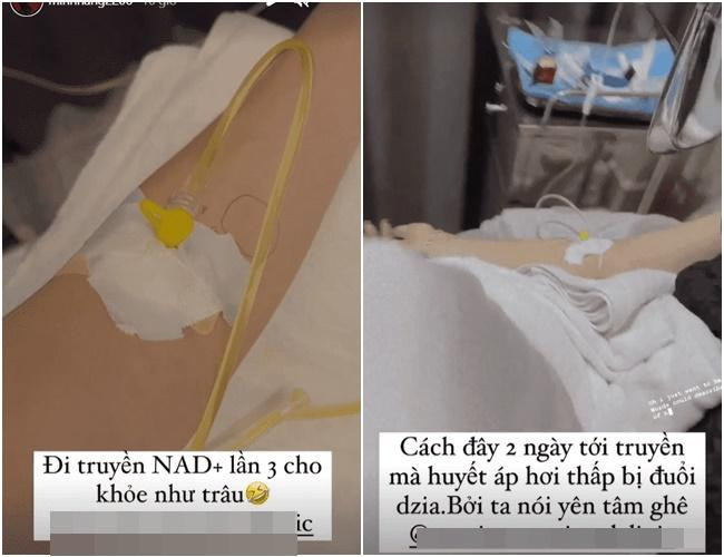 Minh Hằng "sưng hết cả mặt" trước thềm đám cưới - Hình 5 Minh Hang