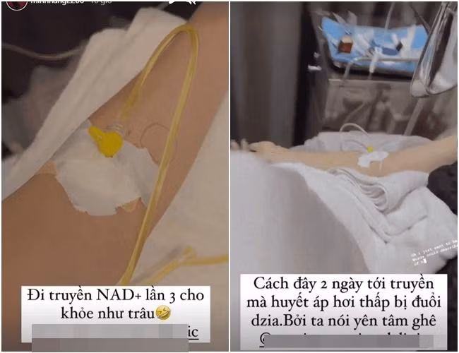 Minh Hằng "sưng hết cả mặt" trước thềm đám cưới - Hình 5 Minh Hang