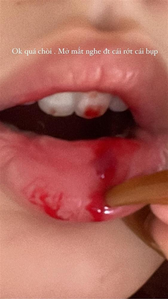 Xoai Non lo anh mau me quanh mieng, nhu bi 