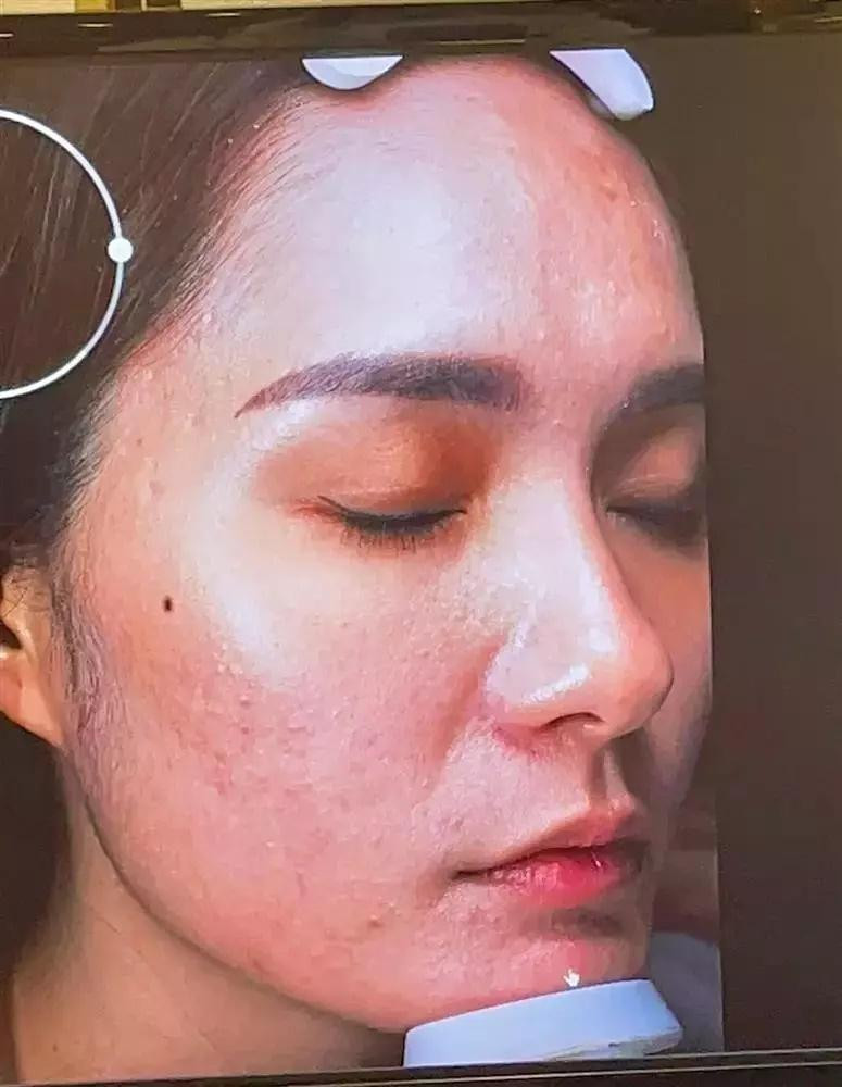 Doan Di Bang veo mui khang dinh 