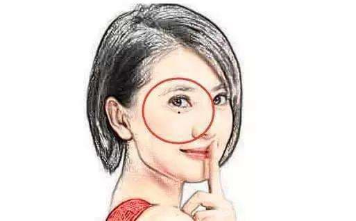 4 vi tri not ruoi dao hoa tren mat, dau la tot xau?-Hinh-4